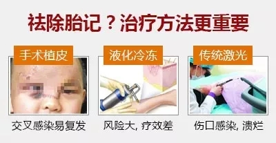 广州胎记专科医院哪家受欢迎