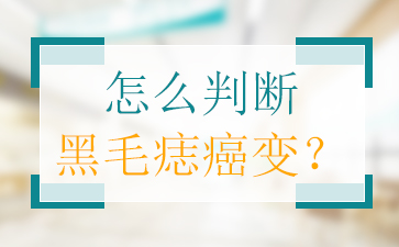 广州胎记医院哪家好，黑毛痣会癌变吗？